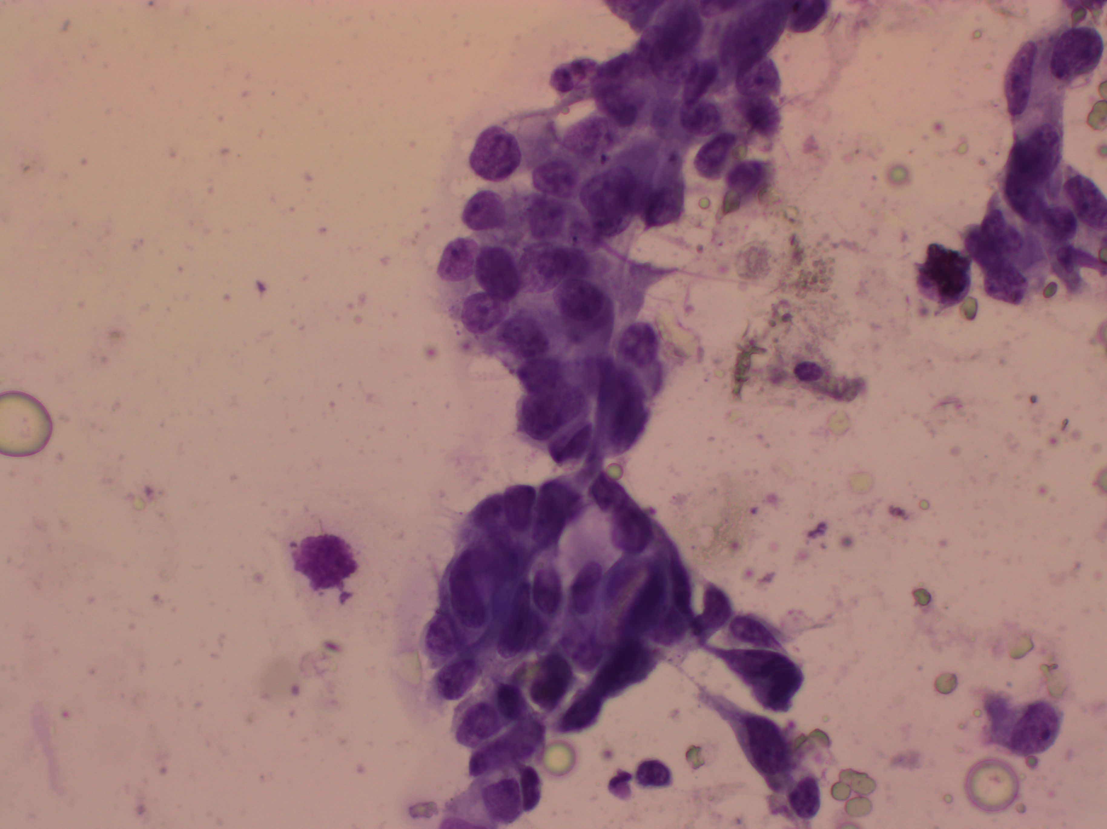 Atlas Of Breast Cancer Early Detection